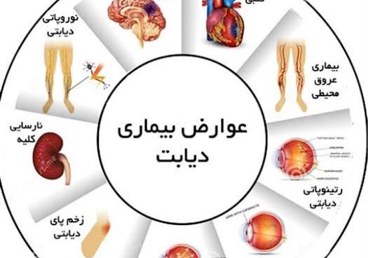دیابت نوع 2: پیشگیری و کنترل امکان‌پذیر است